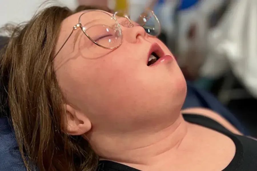 Gwen, Child with Down Syndrome