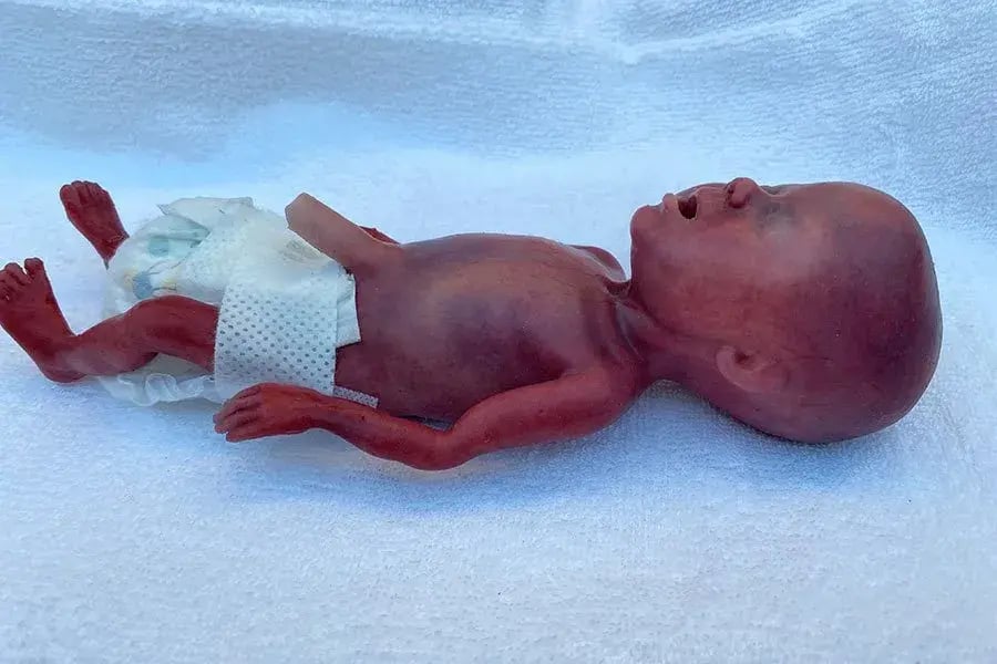 MICRO-PREEMIE